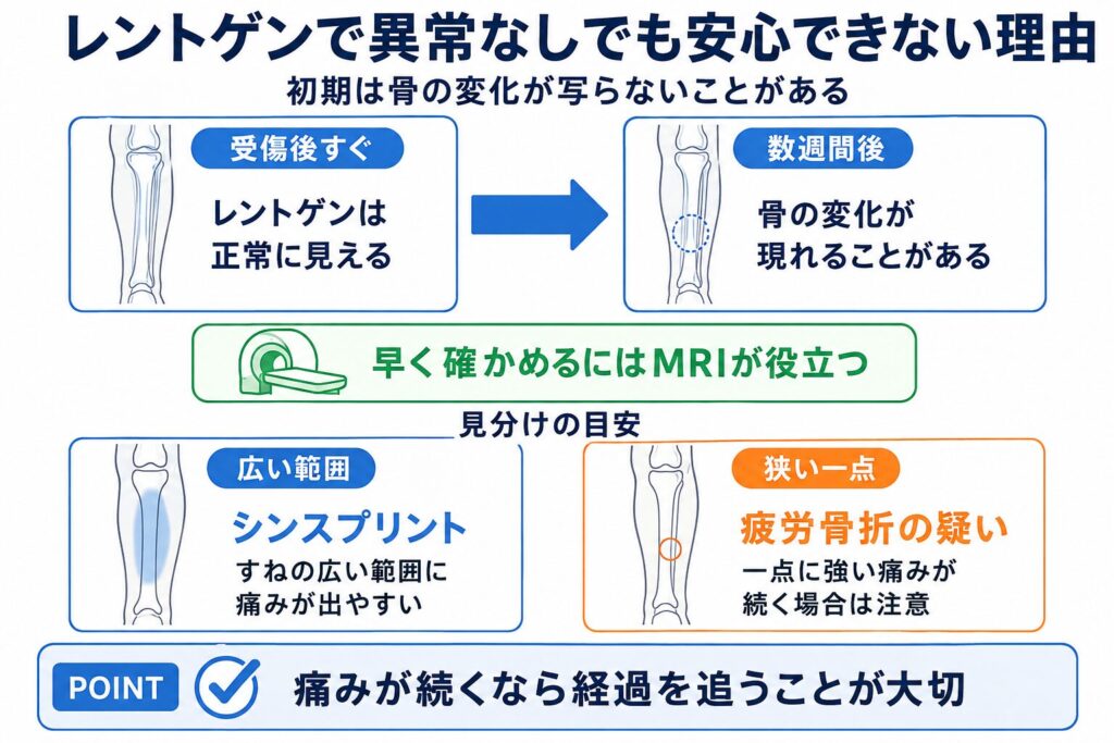 レントゲンで異常なしでも安心できない理由とは?