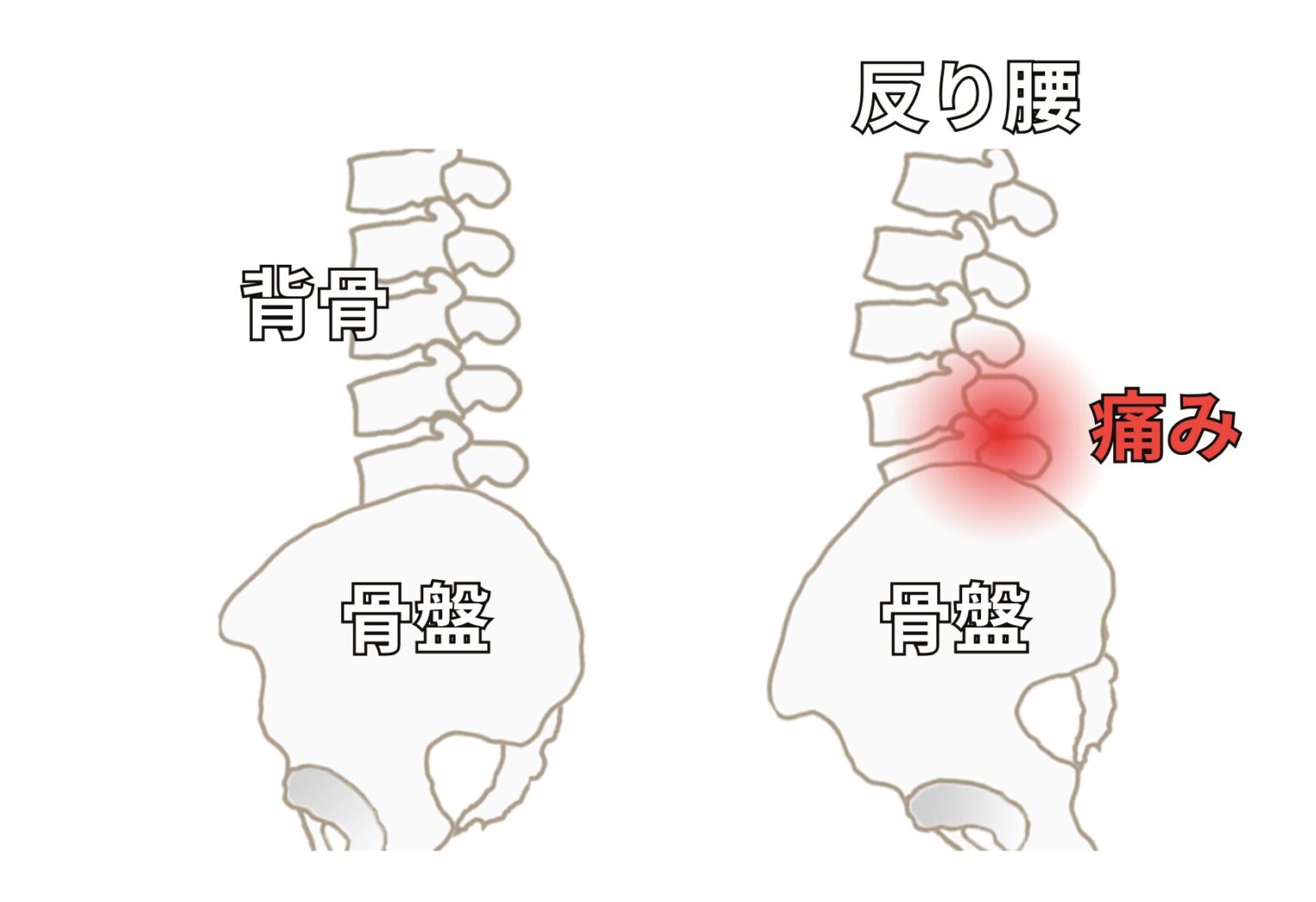 背筋が伸びているのが良い姿勢！？ ～腰の反りすぎが腰痛の原因かも～ | 桃谷うすい整形外科｜大阪天王寺JR桃谷駅近く｜リハビリ・骨粗しょう症 ...