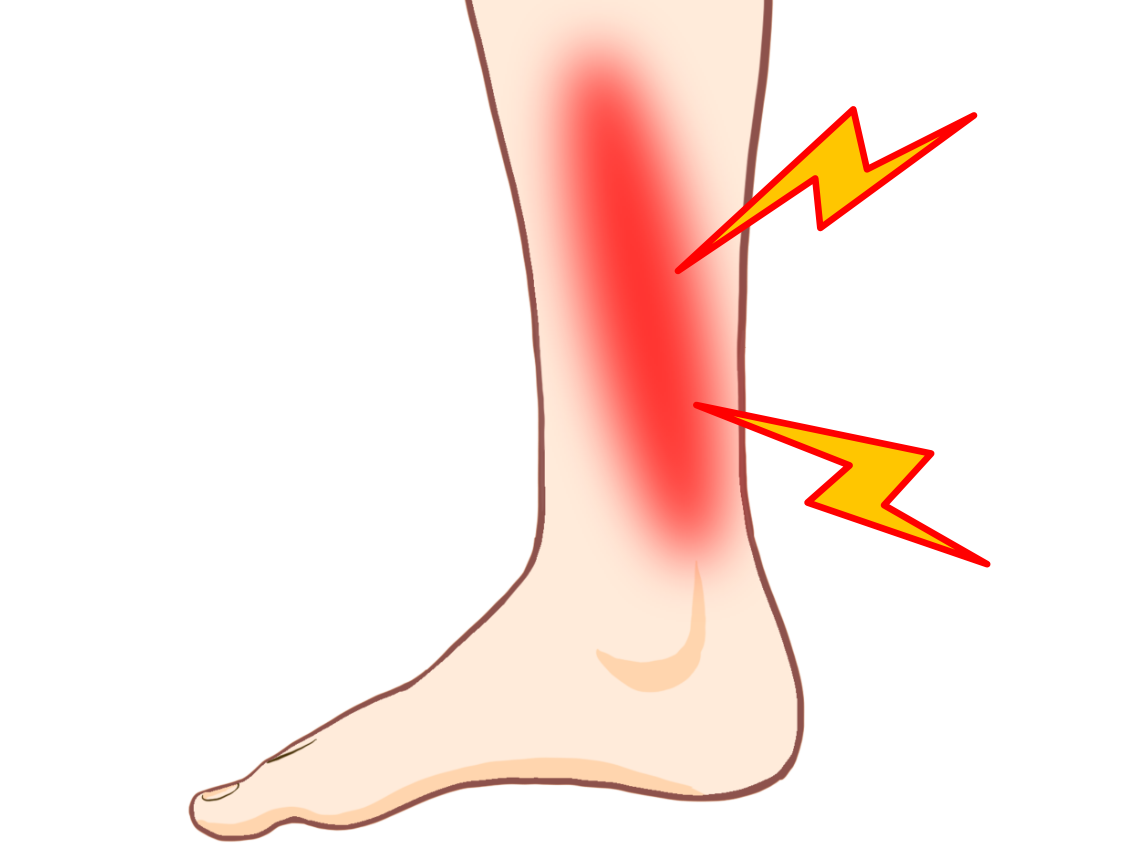シンスプリント