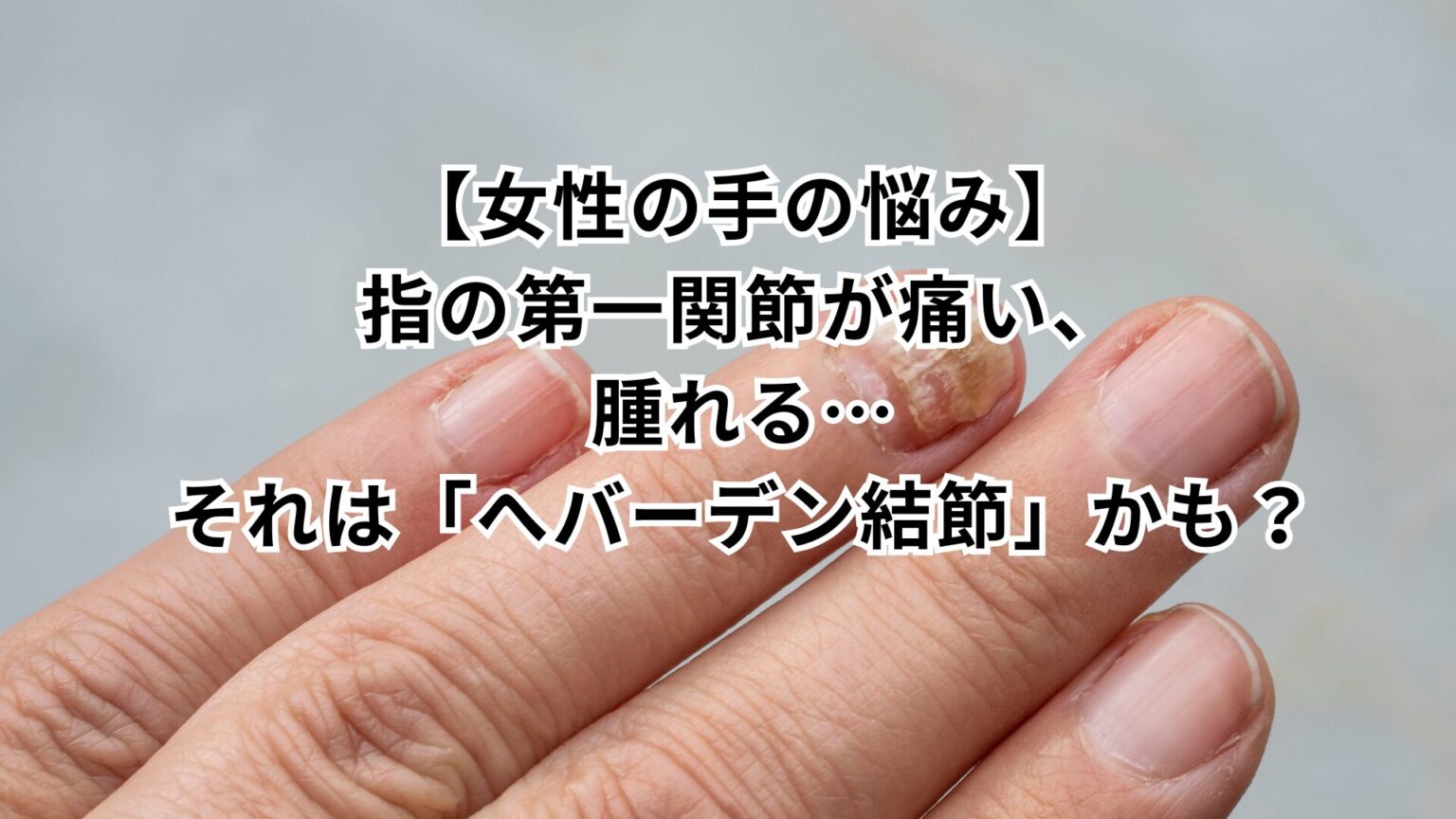 【女性の手の悩み】指の第一関節が痛い、腫れる…それは「へバーデン結節」かも? | 桃谷うすい整形外科|大阪天王寺JR桃谷駅近く|リハビリ・骨 ...