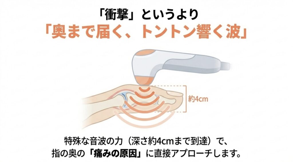 体外衝撃波の原理
