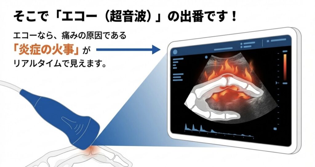 エコーによる検査