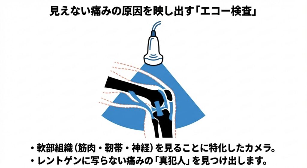 エコー検査について