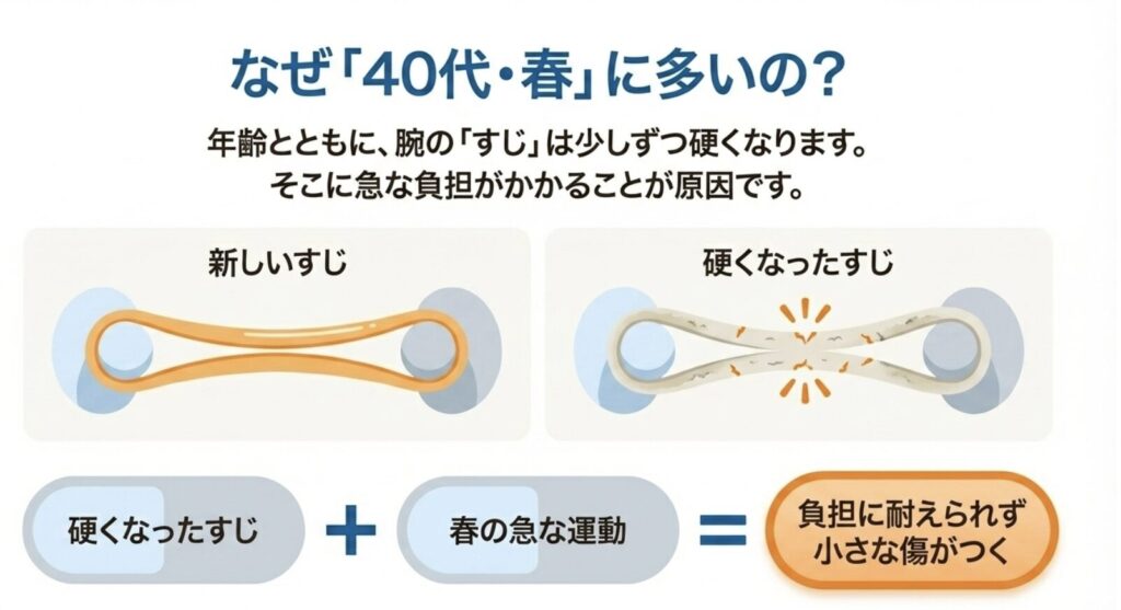 なぜテニス肘が起きやすいのか?