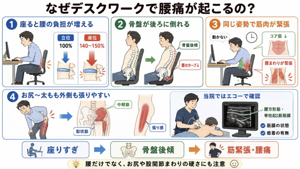 なぜデスクワークで腰痛が起こるの?