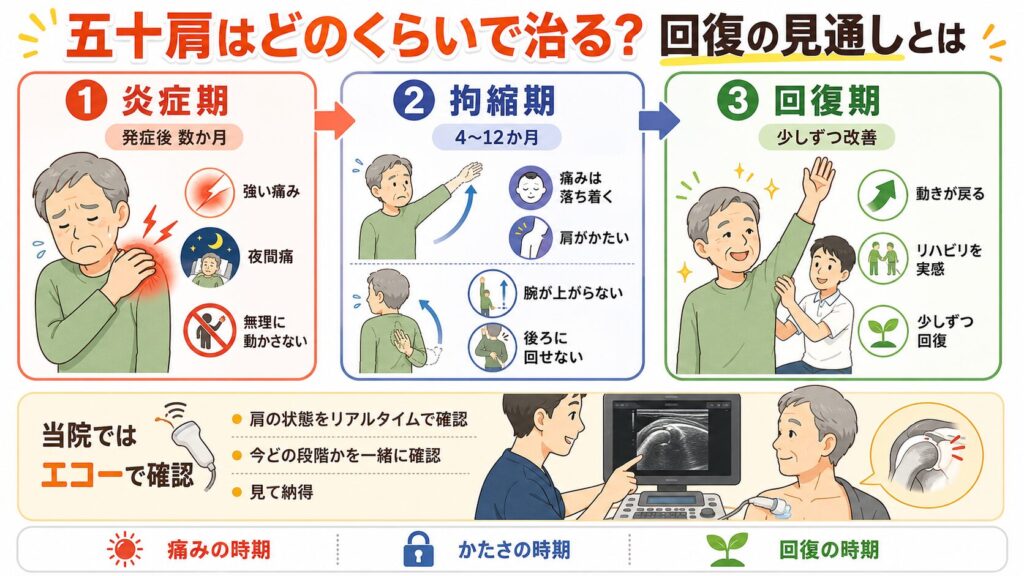 五十肩はどのくらいで治る?回復の見通しとは