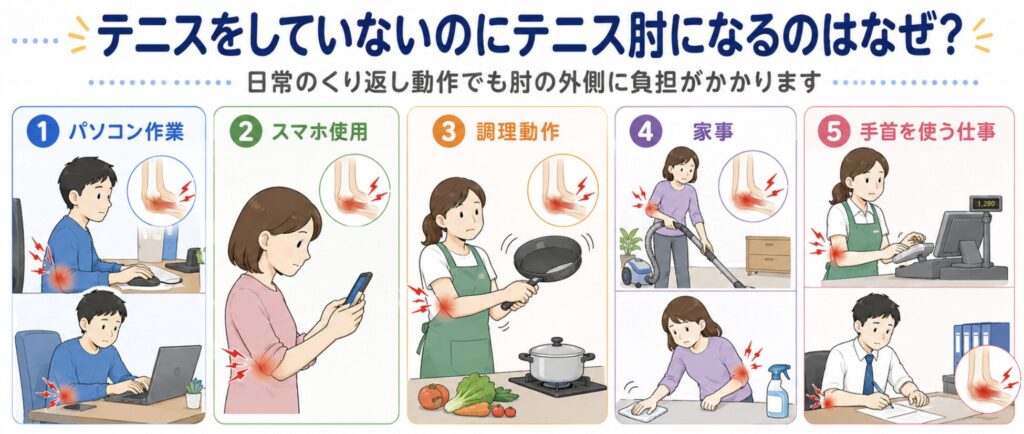 テニスをしていないのにテニス肘になるのはなぜ？
